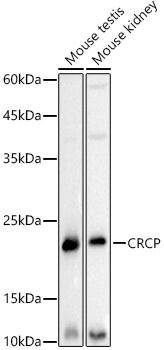 CRCP Antibody (0I6F10)