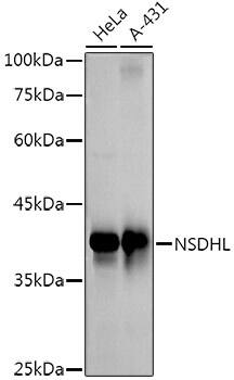 NSDHL Antibody (3K3Q6)