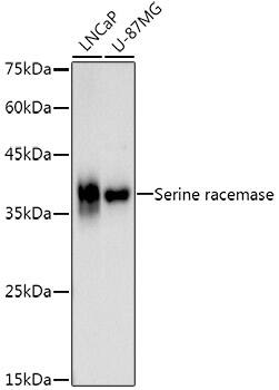 Serine racemase Antibody (0T6G3)