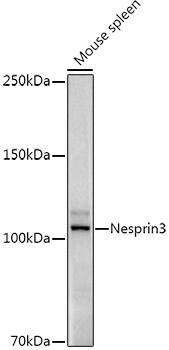 Nesprin-3 Antibody (5P10J3)