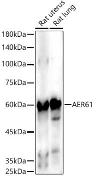 EOGT/AER61 Antibody (10A7W10)