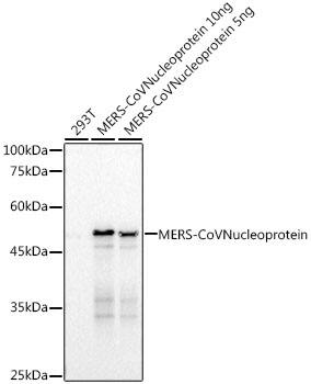 MERS-CoV Nucleoprotein Antibody (1R8L7)