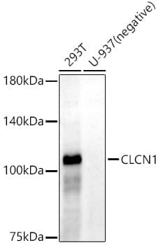 CLCN1 Antibody (0P2M8)