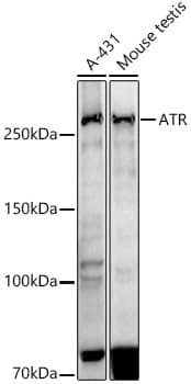 ATR Antibody (4O3E0)