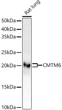 CMTM6 Antibody (6K8M9)