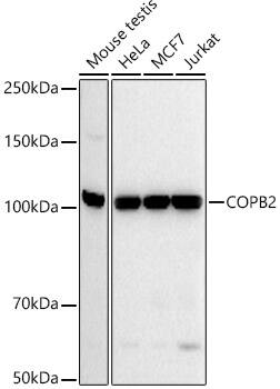 COPB2 Antibody (1X5F7)