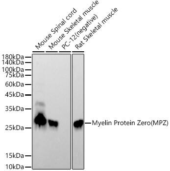 Myelin Protein Zero Antibody (3C4D1)