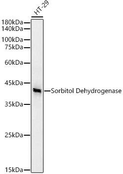 Sorbitol Dehydrogenase Antibody (9Q3B10)