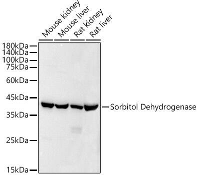 Sorbitol Dehydrogenase Antibody (9Q3B10)