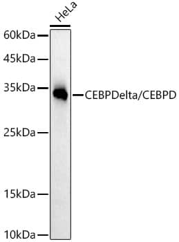 CEBP Delta Antibody (2O1A6)