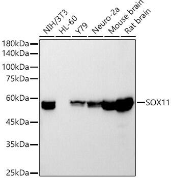 SOX11 Antibody (5K1J5)