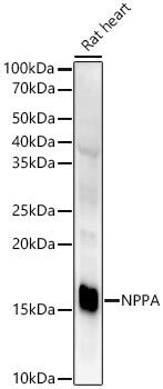 Atrial Natriuretic Peptide/ANP Antibody (2C5S5)