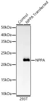 Atrial Natriuretic Peptide/ANP Antibody (2C5S5)