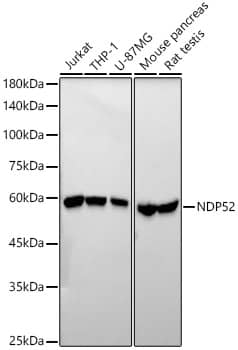 NDP52 Antibody (5O8Y6)