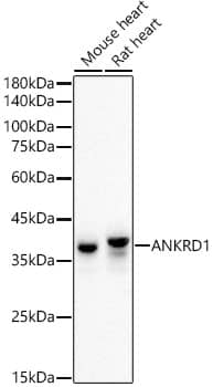 ANKRD1 Antibody (2H4T1)