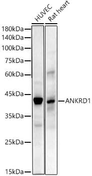 ANKRD1 Antibody (6C3I2)