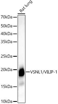 visinin-like 1 Antibody (0R1V3)