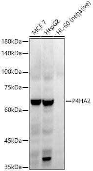 P4HA2 Antibody (6A6Z2)