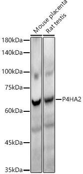 P4HA2 Antibody (6A6Z2)