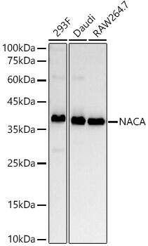 NACA1 Antibody (9S6U3)