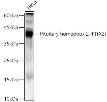 PITX2 Antibody (6X1W3)