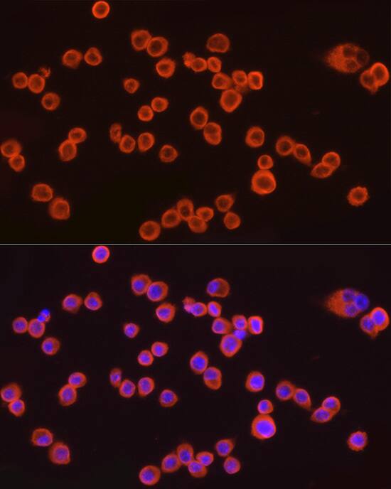 CMTM6 Antibody (7N3H5)