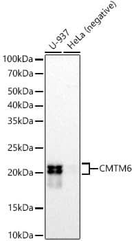 CMTM6 Antibody (7N3H5)