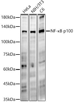 NFkB2/NFkB p100 Antibody (5J6H9)