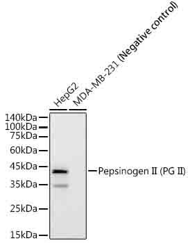 Pepsinogen C/PGC/Progastricsin Antibody (3M7P3)
