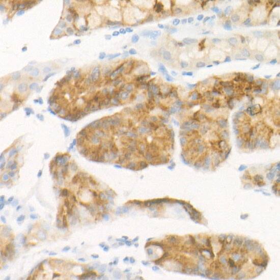 Pepsinogen C/PGC/Progastricsin Antibody (3M7P3)