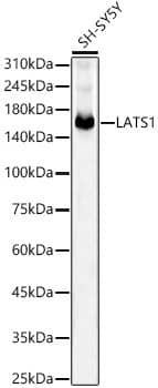 LATS1 Antibody (5I10Q5)