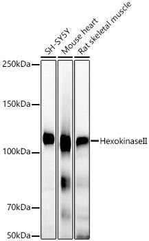 Hexokinase 2 Antibody (5Z8C3)