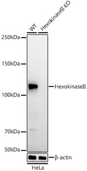 Hexokinase 2 Antibody (5Z8C3)