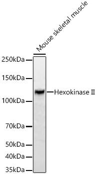 Hexokinase 2 Antibody (5Z8C3)