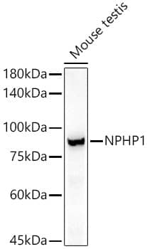 Nephronophthisis Antibody (5M1T6)