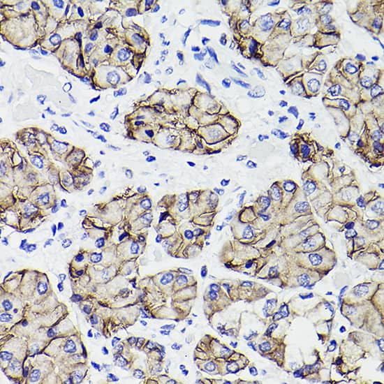 Claudin-18.2 Antibody (3B2B5)