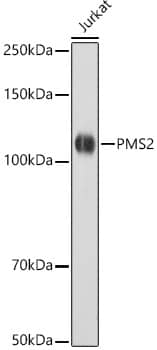 PMS2 Antibody (4T9W4)