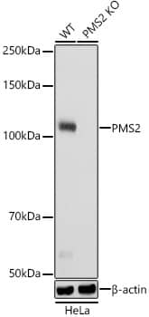 PMS2 Antibody (4T9W4)