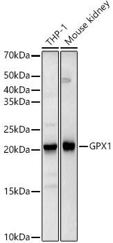 Glutathione Peroxidase 1/GPX1 Antibody (9E5H3)