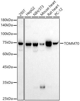 TOM70 Antibody (2Q2U5)