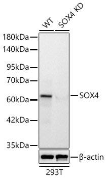 SOX4 Antibody (4A1E8)
