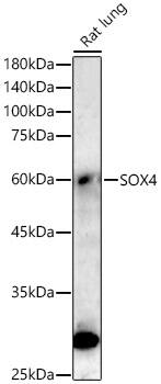SOX4 Antibody (4A1E8)