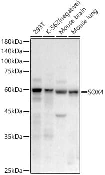 SOX4 Antibody (4A1E8)