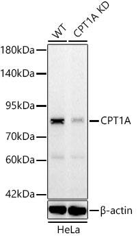 CPT1A Antibody (8Y1J4)
