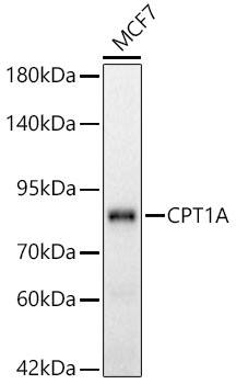 CPT1A Antibody (8Y1J4)