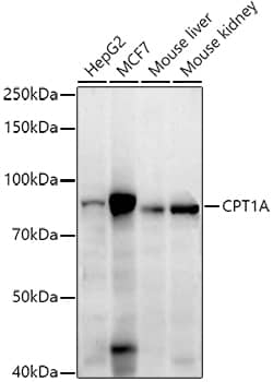 CPT1A Antibody (8Y1J4)