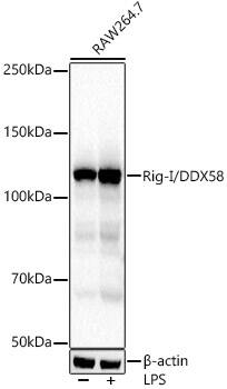 RIG-I Antibody (2J8D5)