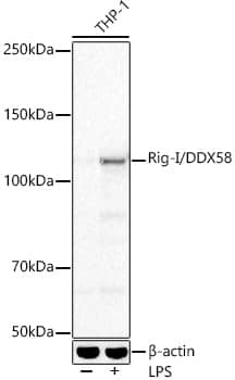 RIG-I Antibody (2J8D5)