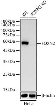 FOXN2 Antibody (9K7D9)