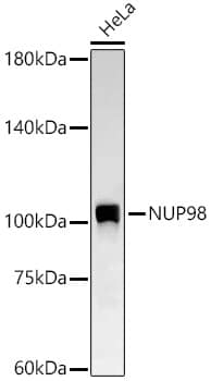 NUP98 Antibody (6M6V6)